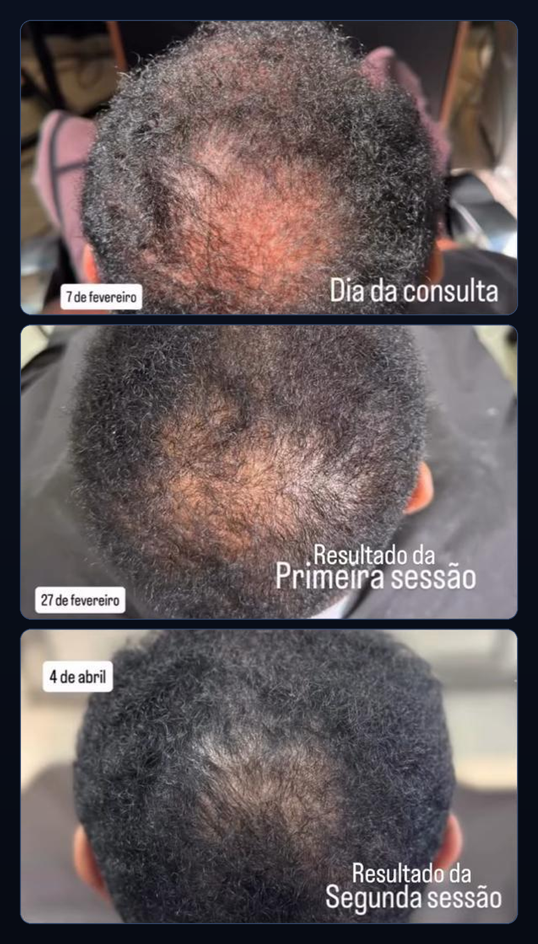 Evolução em 3 sessões: dia da consulta, primeira e segunda sessão