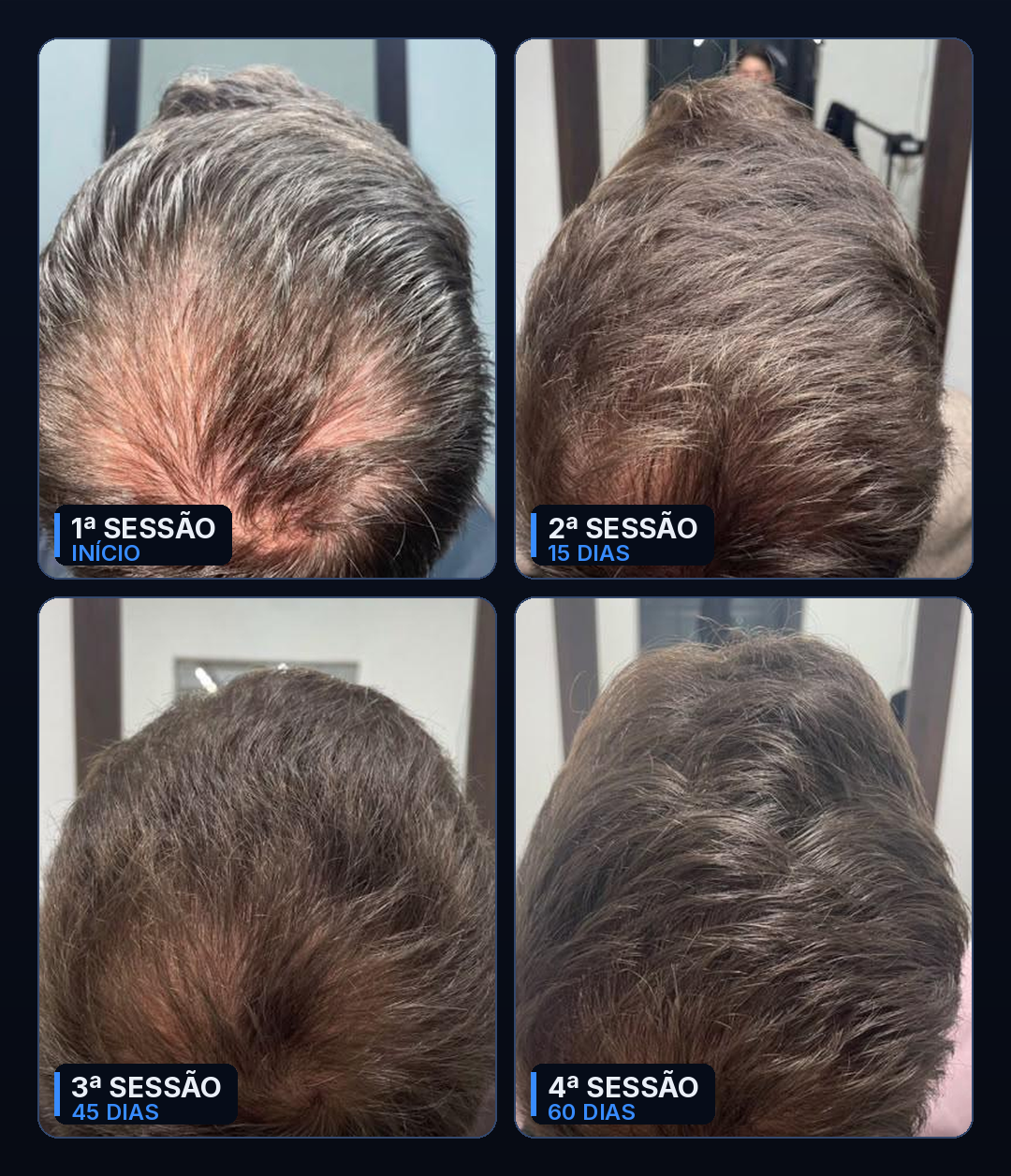 Evolução em 4 sessões ao longo de 60 dias